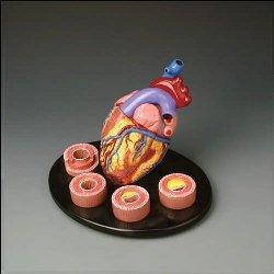 Heart Atherosclerosis